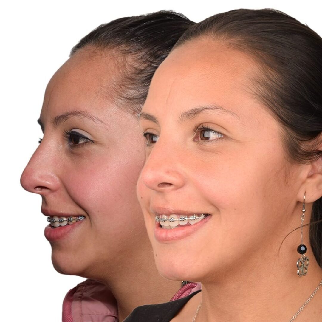 329008494_145289184740298_384003493666221048_n